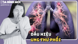 6 dấu hiệu cảnh báo sớm ung thư phổi