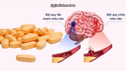 Nghiên cứu: Thừa loại vitamin này có thể tăng nguy cơ đau tim, đột quỵ