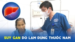 Suy gan vì tự uống thuốc nam theo lời khuyên của hàng xóm