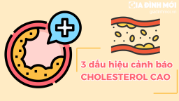 3 dấu hiệu cảnh báo cholesterol cao bạn có thể tự phát hiện mà không cần đến bác sĩ