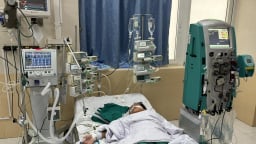 Lọc máu liên tục cứu sống trẻ bị sốc nhiễm khuẩn nặng