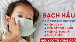 Viêm cơ tim: Biến chứng nguy hiểm hàng đầu khi mắc bệnh bạch hầu