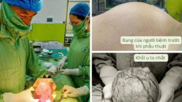 Nhập viện cấp cứu vì dùng thực phẩm chức năng để chữa bệnh