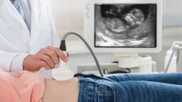Dự thảo Luật Dân số: Lựa chọn giới tính thai nhi có thể bị phạt đến 100 triệu đồng
