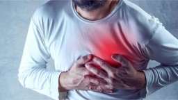Cứu sống nam bệnh nhân bị nhồi máu cơ tim cấp đến từ Pháp