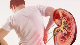 Báo động đỏ: Giới trẻ ngày càng mắc suy thận mạn, nguyên nhân do đâu?