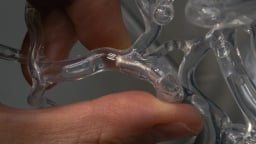 Cứu sống người đột quỵ bằng một thiết bị siêu nhỏ