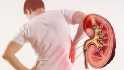 Thế giới có hơn 850 triệu người mắc bệnh lý về thận