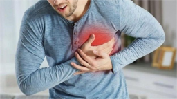 Chuyên gia cảnh báo từ ca đột quỵ của tài tử Huỳnh Anh Tuấn
