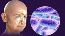 Bộ Y tế khuyến cáo nâng cao phòng, chống bệnh nhiễm khuẩn liên cầu lợn