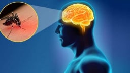 Bệnh viêm não Nhật Bản có thể gây tử vong hoặc tàn phế suốt đời…