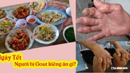 Ngày Tết, người bị gout phải kiêng ăn gì?