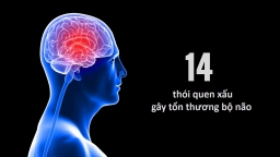 14 thói quen xấu khiến đầu óc cẳng thẳng, dễ cáu giận, nhớ trước quên sau