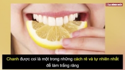 5 loại trái cây giúp răng sạch mảng bám, trắng sáng tự nhiên