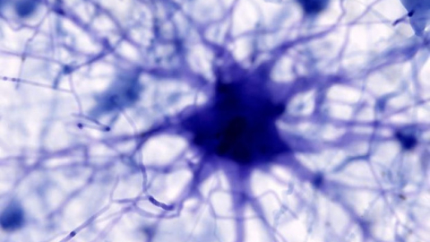 Trí tuệ nhân tạo mang đến hy vọng tìm ra phương pháp điều trị bệnh Alzheimer