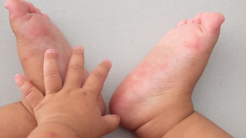 Cảnh báo nguy cơ “dịch chồng dịch”