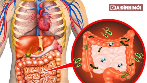 8 dấu hiệu nhận biết cơ thể đang tích tụ nhiều độc tố