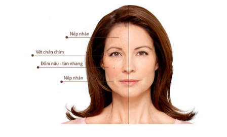 Collagen Yến sào - Khiến bạn đẹp hơn từng khoảnh khắc