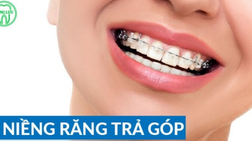 Quy trình niềng răng trả góp tại Phòng Khám Nha Khoa Đăng Lưu