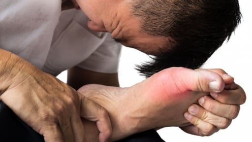 Chế độ ăn cho người mắc bệnh gút (gout): Nên ăn gì và tránh ăn gì?
