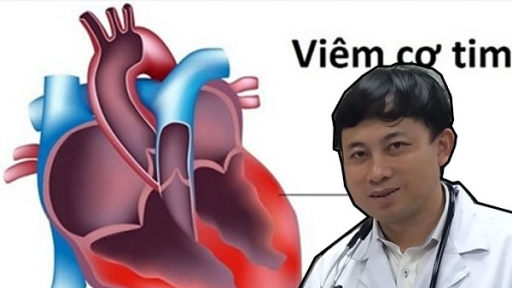 Những dấu hiệu bệnh viêm cơ tim cần nhập viện ngay theo chuyên gia tim mạch chỉ dẫn