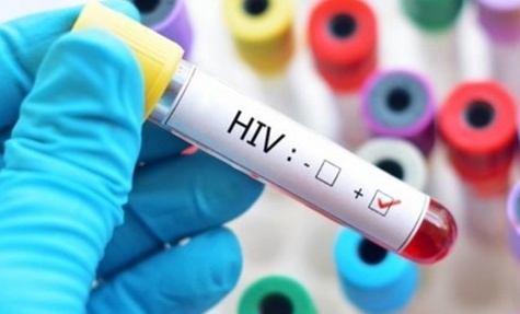 Cục phòng chống HIV/AIDS lên tiếng về thông tin có chủng virus mới