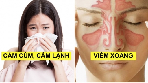 6 bệnh không cần sử dụng ngay kháng sinh nhưng bệnh nhân thường lạm dụng