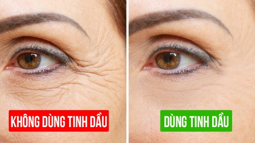 6 loại dầu tự nhiên chống lão hóa, đánh bay nếp nhăn hiệu quả