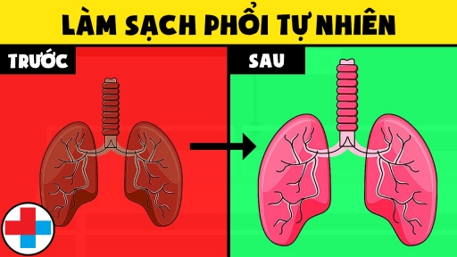 Vào 'mùa' ô nhiễm không khí, áp dụng ngay 7 cách làm sạch phổi tự nhiên không cần dùng thuốc