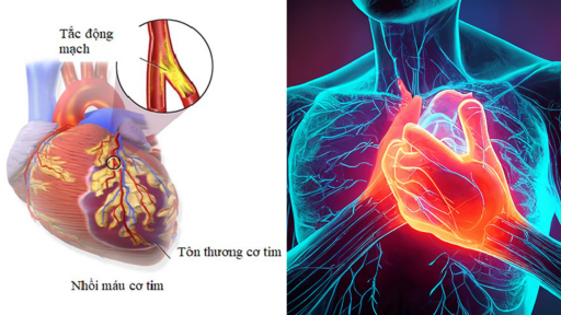 5 dấu hiệu vào ban đêm âm thầm cảnh báo cơn đau tim sắp ập đến