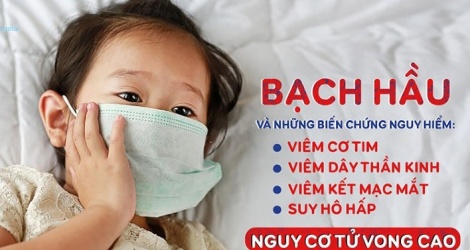 Viêm cơ tim: Biến chứng nguy hiểm hàng đầu khi mắc bệnh bạch hầu