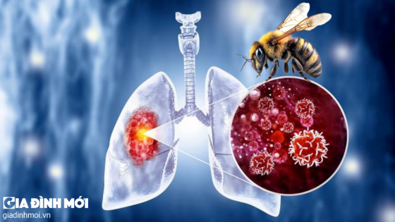 Nghiên cứu: Ong mật có thể phát hiện ung thư phổi