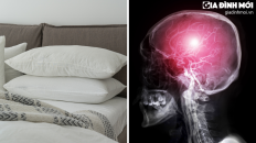 Nghiên cứu: Ngủ gối cao có thể tăng nguy cơ đột quỵ