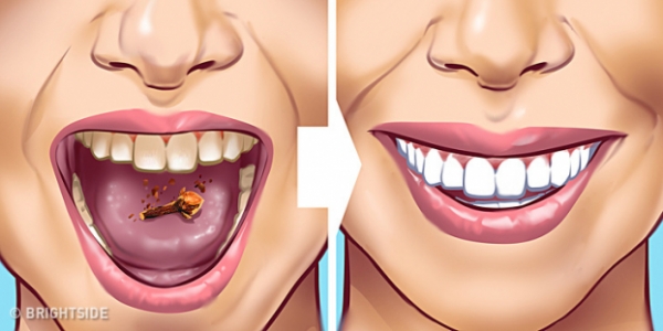 11 cách loại bỏ vết ố, mảng bám trên răng, hôi miệng cỡ mấy cũng thơm tho ngay lập tức 8