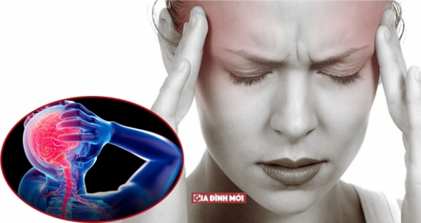   Ngoài thuốc giảm đau, có thể sử dụng một số biện pháp hiệu quả để trị đau nửa đầu  