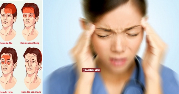   Hiểu rõ các triệu chứng đau đầu giúp bạn phát hiện sớm nhiều căn bệnh nguy hiểm  