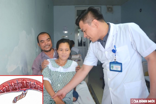 Sản phụ Nguyễn Thị Lành bị rau cài răng lược hiếm gặp được cứu sống thành công