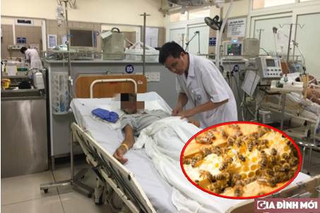 Bệnh nhân bị ong đốt dẫn đến bị suy đa phủ tạng đang được điều trị tại Bệnh viện Bạch Mai