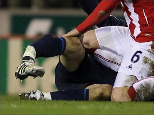 Những pha va chạm trên sân cỏ gây ra nhiều chấn thương nguy hiểm cho các cầu thủ. Ảnh minh họa