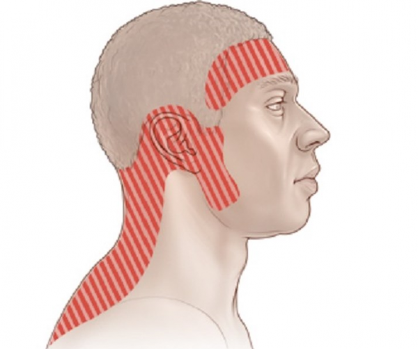   Nếu bạn xuất hiện những cơn đau nhức vùng đầu ở vị trí này có thể bạn đang bị căng thẳng.  