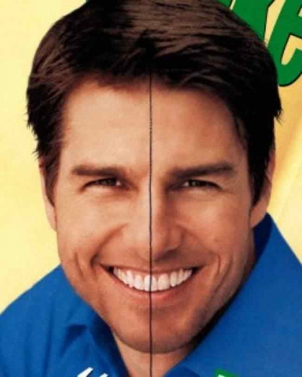   Răng của Tom Cruise bị lệch so với trung tâm khuôn mặt của anh ấy  