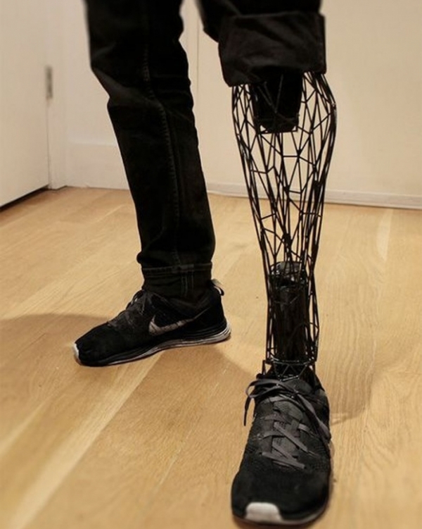   Chân giả chân in 3D  