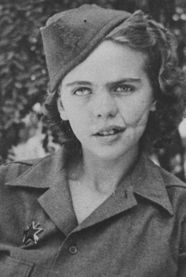   Đây là Albina Mali-Hočevar - một cô gái đến từ Nam Tư đã bị thương nhiều lần trong Thế chiến thứ hai.  