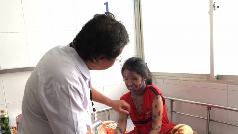 Tình trạng trẻ em bị bệnh thủy đậu gia tăng ở Tp Hồ Chí Minh