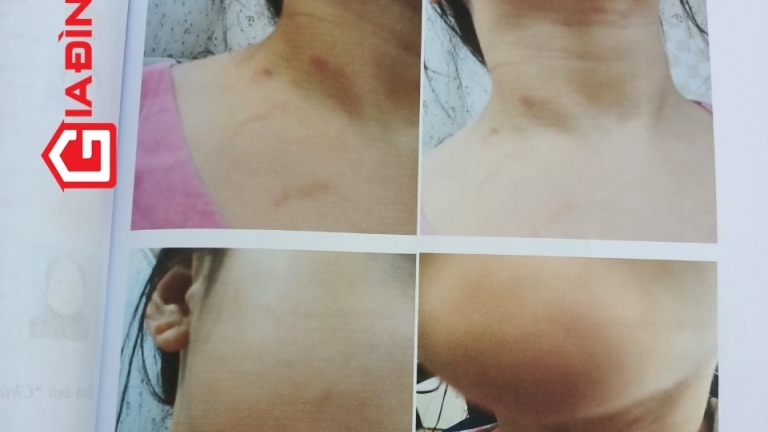 Vụ ông bà nội khẩn cầu 'giải cứu' 2 cháu: Cục Trẻ em lên tiếng