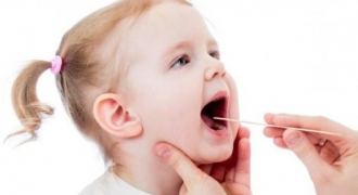 Dấu hiệu nhận biết, cách điều trị và phòng ngừa viêm amidan ở trẻ em