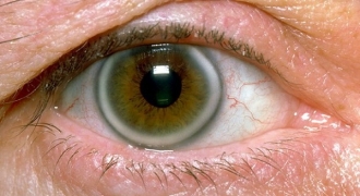 Bác sĩ nêu 7 dấu hiệu lạ ở mắt cảnh báo sức khỏe không thể xem thường