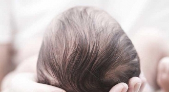 Tại sao trẻ sơ sinh lại có cứt trâu ở đầu?