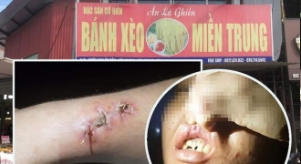 Chủ quán bánh xèo tại Bắc Ninh dùng dao, chày, xẻng đánh đập nhân viên