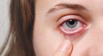 Các vấn đề nhiễm trùng mắt thường gặp trong mùa mưa